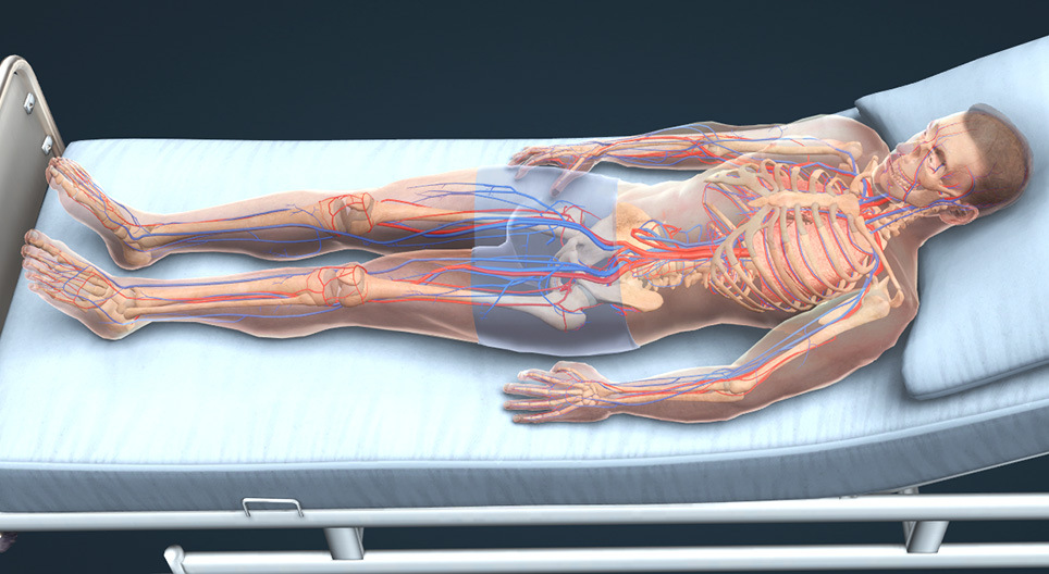 Deep vein thrombosis and pulmonary embolism