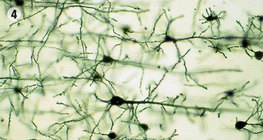 Мэдрэлийн эд