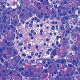 Нойр булчирхайн инсулин үүсгэдэг бүлэг эсүүд