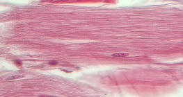 Шөрмөс (уртааш огтлол)