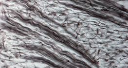 Фибромөгөөрсний эд (гахайн үр хөврөлийн хамарнаас авсан)