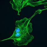 Цитоскелетон