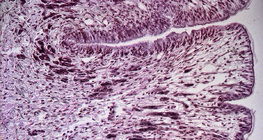 Эмгэн хумсны хөлний хөндлөн огтлол