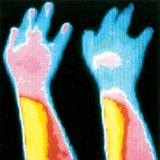 Vasoconstriction caused by smoking