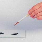 A nyál szerepének vizsgálata 