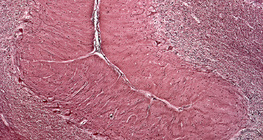 Хүний бага тархины огтлол