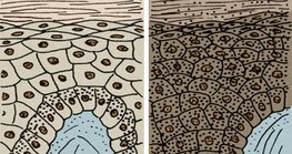 Хар ба цагаан арьст хүмүүсийн арьс