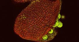 Мирабилис цэцгийн тоосны уут нээгдсэн байгаа нь (зэрэгцээ фокустай лазер микроскопын зураг)
