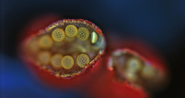 Мирабилис цэцгийн тоосны уут нээгдсэн байгаа нь (оптикийн микроскопын зураг)