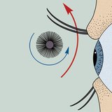 Сормуусны будаг хэрэглэх