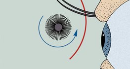 Сормуусны будаг хэрэглэх