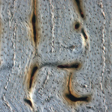 Яс (уртааш огтлол)