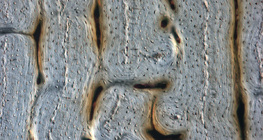 Яс (уртааш огтлол)