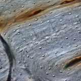 Яс (уртааш огтлол)