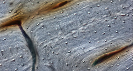 Яс (уртааш огтлол)