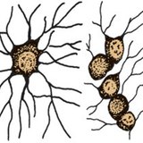 Мэдрэлийн туслах эс (глиал эс)