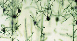 Тархины бор гадаргын мэдрэлийн эсүүд