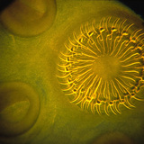 Tapeworm scolex (head) with hooks and suckers