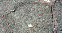 Элэгний хөндлөн огтлол (гахай)