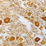 Нуруу нугасны зангилааны мэдрэлийн эсүүд