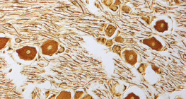 Нуруу нугасны зангилааны мэдрэлийн эсүүд