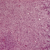 Бөөрний дээд булчирхайн хөндлөн огтлол