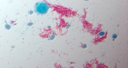 Сүрьеэ өвчин үүсгэгч (Mycobacterium tuberculosis)