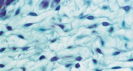 Хөвсгөр холбогч эд