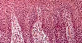 Хүний хэлний хөндлөн огтлол