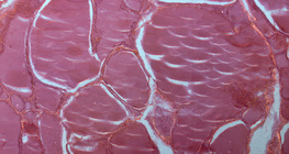 Бамбай булчирхайн хөндлөн огтлол