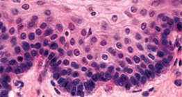 Үелсэн, кератинжээгүй хайрсан эд