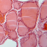 Бамбай булчирхайн хөндлөн огтлол