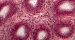 Үрийн гуурсан хоолойн хөндлөн огтлол