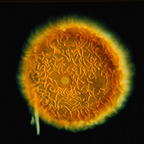 Sponge gemmule (Spongilla lacustris)