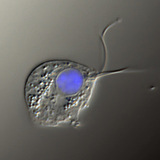 The causative agent of Trichomonas vaginalis (differential interference contrast image, the nucleus is stained blue) The causative agent of Trichomonas vaginalis (differential interference contrast image, the nucleus is stained blue)