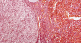 Гипофиз булчирхай (уртааш огтлол, бага зэрэг томруулсан)