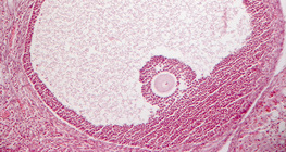 Өндгөвчний хөндлөн огтлол (хөхтөн)