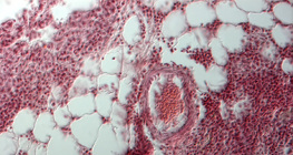 Хүний уушигний огтлол