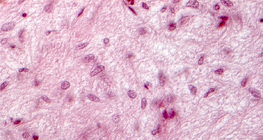 Гипофиз булчирхайн огтлол