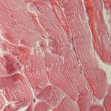 Шөрмөс (хөндлөн огтлол)