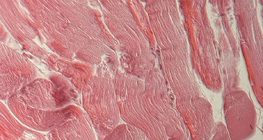 Шөрмөс (хөндлөн огтлол)