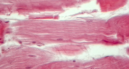 Шөрмөс (уртааш огтлол)