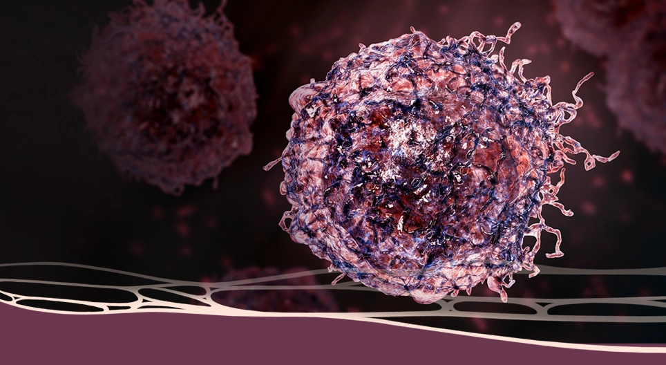 Аймшигт онош: Хорт хавдар