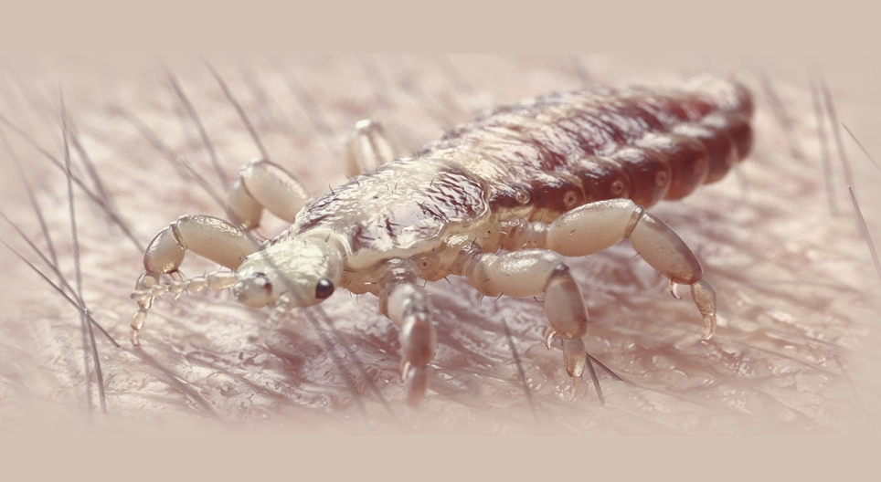 Pediculosis